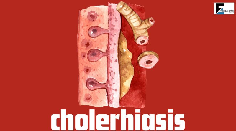 cholerhiasis
